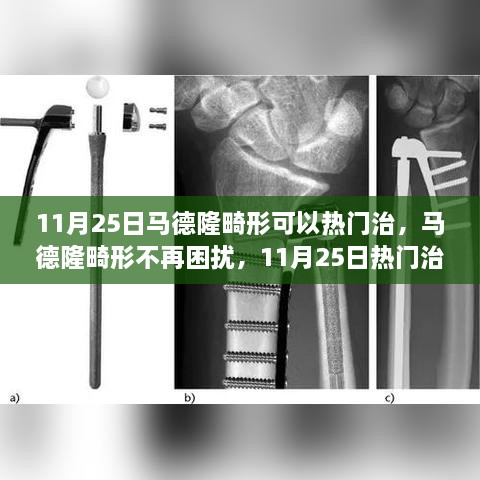 马德隆畸形热门治疗启示录，自信重塑与成长之旅