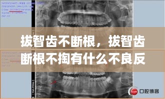 拔智齿不断根，拔智齿断根不掏有什么不良反应 