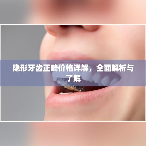 隐形牙齿正畸价格详解，全面解析与了解