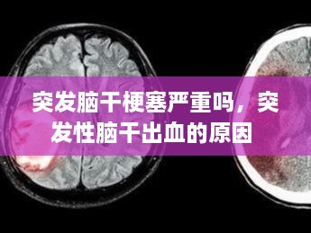 突发脑干梗塞严重吗，突发性脑干出血的原因 